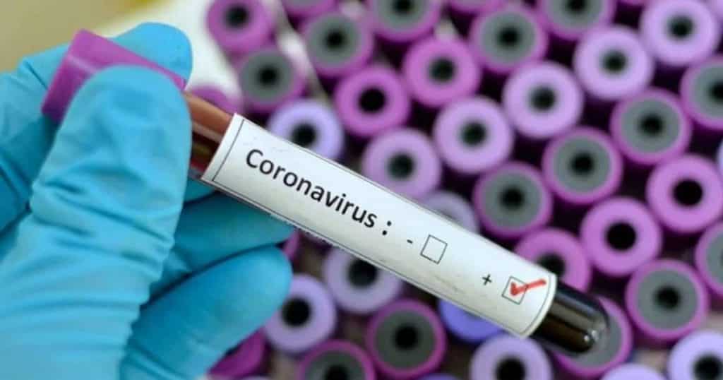 En México no hay especialistas de coronavirus